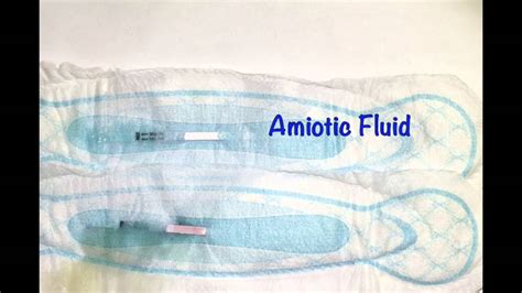 how to tell if your leaking amniotic fluid|Leaking Amniotic Fluid: How to Tell